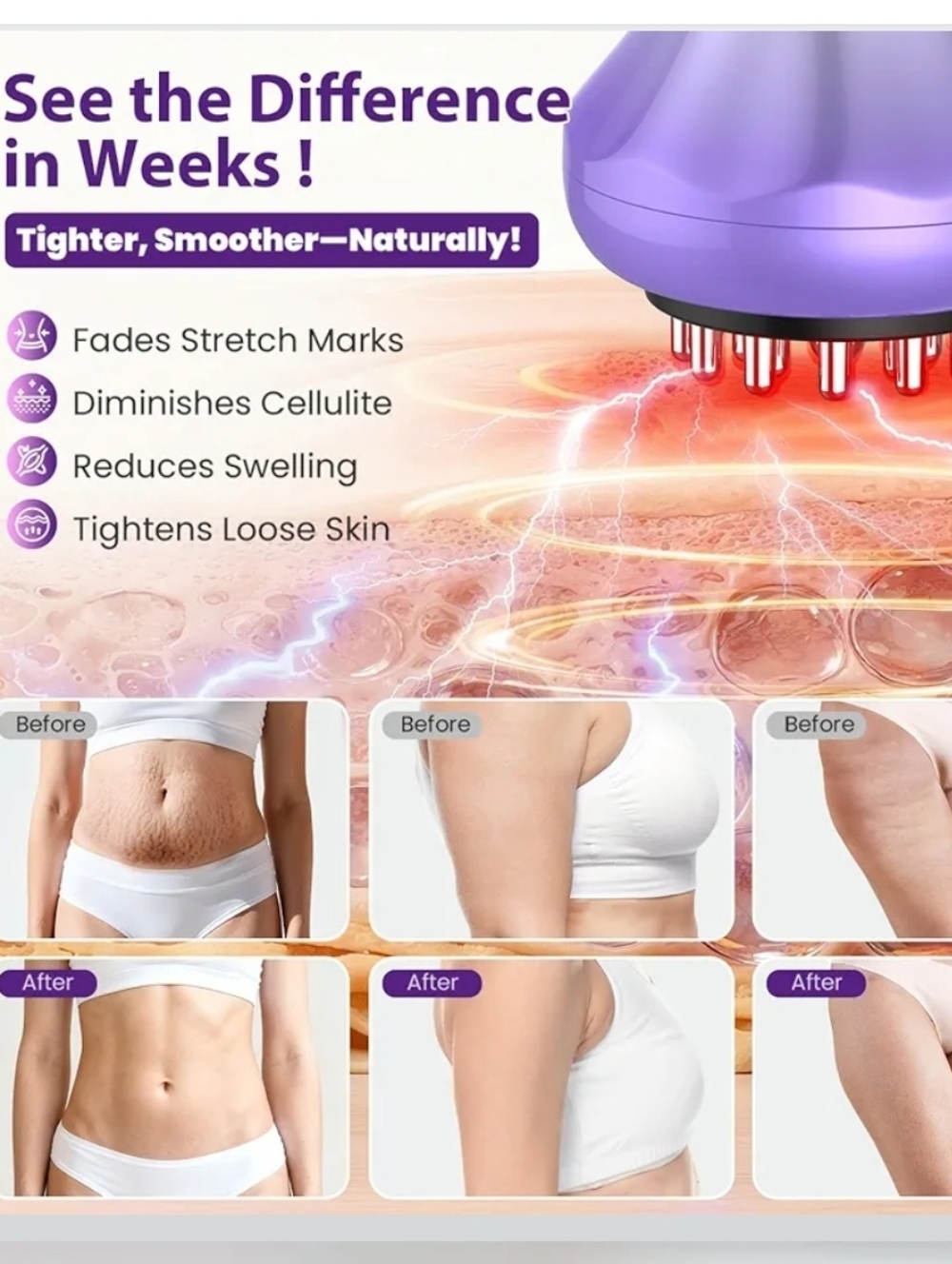 Purple Handheld 4-in-1 Body Massager. Lymphatic Drainage Body Sculpting - Picture 6 of 7